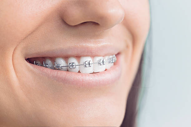 Best Teeth Whitening  in Wayne City, IL